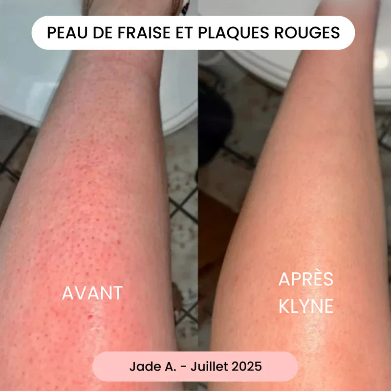 KLYNE®-rakhyvel – Rakningsinnovation för en mjuk och hälsosam hud