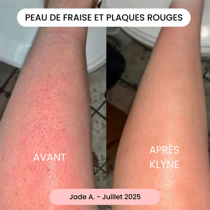 KLYNE®-rakhyvel – Rakningsinnovation för en mjuk och hälsosam hud